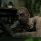 Zombie Collection - Dismembered Male